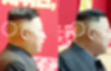 Kesehatannya Sempat Dirumorkan Dalam Kondisi Buruk, Tanda di Kepala Kim Jong-Un Ini Seolah Beri Petunjuk Jika Pemimpin Korea Utara Itu Sedang 'Tidak' Baik-Baik Saja