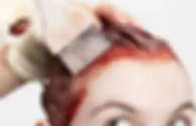 Hobi Mewarnai Rambut, Wanita Ini Berakhir dengan Penyesalan Usai Didiagnosis Dokter Mengidap Penyakit Serius yang Nyaris Merenggut Nyawanya
