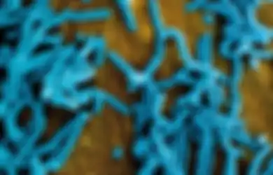 Covid Belum Usai, WHO Justru Peringatkan Serangan Virus Marburg yang Jadi Ancaman Bahaya