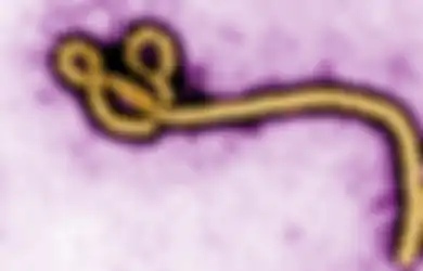 Afrika Barat Dilanda Kemalangan Bertubi-tubi, Covid-19 Belum Tuntas, Wabah Baru Virus Marburg dan Ebola Muncul Menambah Derita
