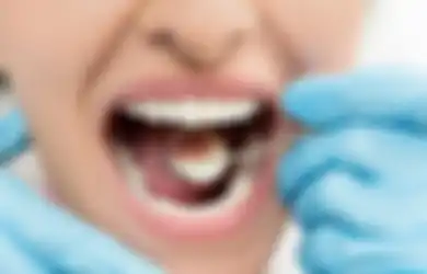 Cegah Gigi Berlubang, Kurangi Makanan Manis dan Lakukan 2 Hal Ini!