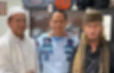 Pengacara Ryan Jombang Lapor Bareskrim, Mata Korban Bogem Mentah Habib Bahar bin Smith Masih Bengkak dalam Foto Bukti Damai