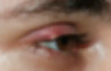 Hati-hati! Malas Bersihkan Make Up Hal Menyakitkan ini Bisa Kamu Alami, Ketahui Tiga Penyebabnya