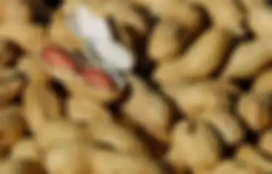 Kerap Dituding Jadi Penyebab Jerawat, Benarkah Makan Kacang Sebabkan Masalah Kulit ini? Simak Penjelasannya