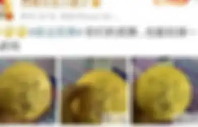 Noda Kecil Makin Besar hingga Terkelupas, 2 Atlet China Ini Sampai Tak Berani Pegang Lagi Medali Emas Olimpiade Tokyo 2020 Miliknya, Terungkap Fakta Sebenarnya yang Bikin Syok