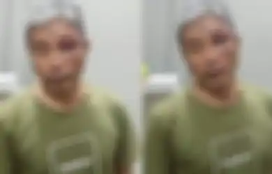 Disebut Lumuri Muhammad Kece dengan Tinja, Jenderal Napoleon Bonaparte Ungkap Fakta Sebenarnya, Foto Tampang Bengap Sang YouTuber Jadi Bukti