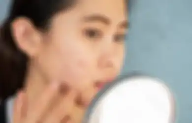 Wajib Dicoba 5 Trik Agar Wajah Cerah Bak Iklan Skincare, Bebas Bekas Jerawat dan Kulit Kusam
