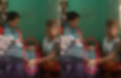 Terlahir Dengan Kulit Mirip Ular, Bocah 16 Tahun Alami Kondisi Langka hingga Harus Lakukan Hal Ini Tiap 3 Jam Sekali, Begini Kisah Pilu sang Ibu Ratapi Kondisi Buah Hatinya