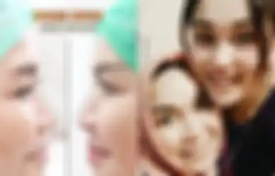 Permak Wajah Habis Rp 100 Juta, Begini Transformasi Penampilan Ibunda Ayu Ting Ting Setelah Perawatan, Dagu dan Pipinya Berubah
