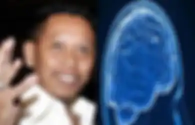 Menyerang Tukul Arwana Secara Tiba-tiba, Ini Dia Penanganan Pertama yang Bisa Dilakukan pada Orang yang Mengalami Pendarahan Otak