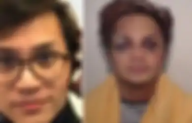 Hukuman Masih Berlangsung, Reynhard Sinaga Pelaku Pelecehan Seksual di Inggris Viral Lantaran Wajahnya yang Babak Belur, Korban Ungkap Faktanya