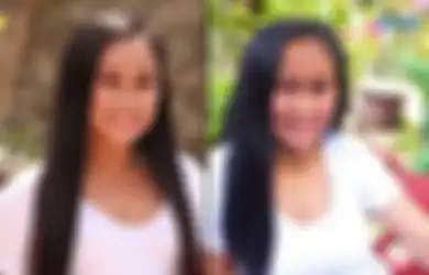 Wajah Gadis 16 Tahun Ini Mendadak Berubah Tua Penuh Keriput Bak Nenek-nenek, Dokter Syok Penyakit Langka Ini Jadi Penyebabnya