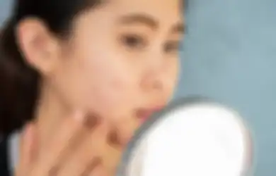 Wajah Jerawatan Bakal Makin Kacau Jika Pakai 3 Skincare Ini di Saat yang Tidak Tepat