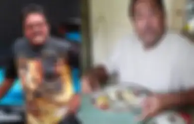 Kini Hidup Tanpa Empedu, Rano Karno Ngaku Sampai Dilarang Lakukan Aktivitas Berat oleh Keluarga, Dokter Ungkap Makanan yang Mudah Ditemui di Indonesia Ini Diduga Jadi Penyebab Utamanya