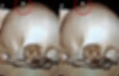 Terus Keluarkan Nanah dan Tak Kunjung Sembuh, Dokter Syok Temukan Gigi Manusia Menancap di Luka Kepala Anak Ini, Tim Medis Bongkar Fakta Mencengangkan