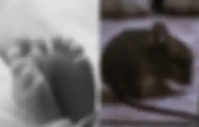 Jari-jarinya Habis Tak Tersisa Dimakan Tikus, Bayi yang Baru 10 Hari Lahir Ini Meninggal Dunia, Kondisinya Mengenaskan