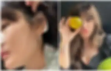 Impan Hidung Jebol hingga Hampir Tembus Kulit, Angela Lee Lakukan Tindakan Medis Ini, Sang Artis Sarankan Orang Lain Tak Ikuti Jejaknya Operasi Plastik