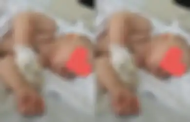 Orang Tua Hanya Bisa Nangis Pilu, Dikira Cuma Tumbuh Gigi Biasa, Ternyata Bayinya Derita Penyakit Mengerikan hingga Harus Rasakan Perihnya Operasi 