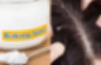 Kelebihan Minyak di Rambut Hingga Sebabkan Ketombe, Coba Gunakan Baking Soda untuk Serap Minyak Berlebihan itu, Begini Cara Pakainya, dan  Fungsi Lain Bahan Dapur Ini!