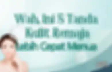 Pantesan Aja, Ini 5 Tanda Kulit Remaja Lebih Cepat Menua, Girls! 