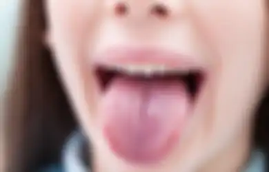 Jangan Anggap Remeh, Mulai Sekarang Waspada Jika Warna Lidah Berubah Seperti Ini, Bisa Jadi Tanda Kanker Bersarang dalam Tubuh