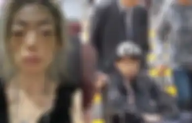 Dulu Jadi Supermodal Tajir, Wanita Ini Telan Pil Pahit Usai Dinikahi Pria Konglomerat, Kondisinya Berakhir di Kursi Roda