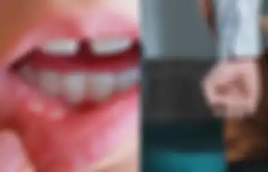 Wali Murid Keroyok Guru SD di Bengkulu Sampai Polisi Turun Tangan, Singgung Murid yang Sedang Sariawan, Ternyata Masalahnya Berawal dari Ini