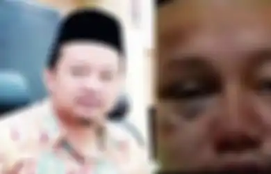 Tampang Bejatnya Bonyok hingga Lebam, Kondisi Herry Wirawan Usai Masuk Rutan Bikin Heboh, Terkuak Perlakuan Para Tahanan Terhadap sang Ustaz Cabul