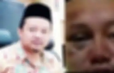Posisinya Kini Sedang Mendekam Rutan Kelas 1 Bandung, Tersebar Foto Wajah Babak Belur Herry Wirawan si Pemerkosa 21 Santriwati, Berikut Klarifikasi Kepala Rutan