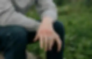 Bukan Maksud Hati Menakut-nakuti, Waspada Jika Muncul Memar di Kulit Tanpa Sebab, Bisa Jadi Pertanda Tubuh Terserang Penyakit Ini