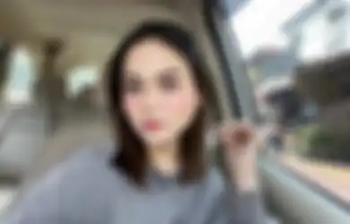 Laura Anna Meninggal Dunia, Kecelakaan 2 Tahun Lalu Membuatnya Lumpuh hingga Idap Ulkus Dekubitus