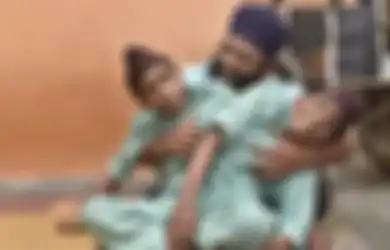 Lahir dengan Kondisi Menyatu, Anak Kembar Siam Ini Dulu Dihina dan Ditinggalkan Orangtua Saat Usia 2 Bulan, Nasibnya Kini Sungguh Tak Terduga!