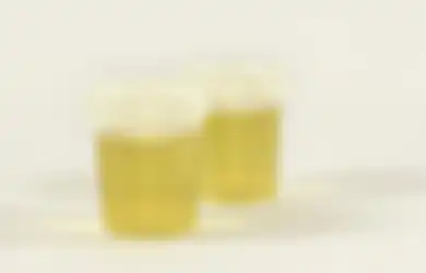 Urine Berbusa, Haruskah Khawatir? Dehidrasi dan 3 Hal Ini Penyebabnya!