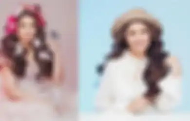 Terlahir dengan Bibir Sumbing, Wanita Cantik Ini Curhat Kerap Diejek hingga Ditolak Calon Mertua, Kini Nasibnya Bikin Melongo!