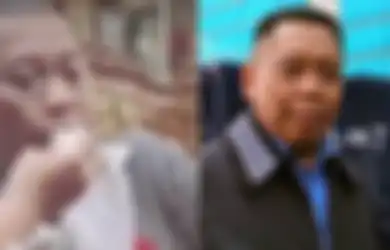 'Cuma Butuh Keajaiban' Keluarga Kini Hanya Bisa Pasrah, Kondisi Tukul Pasca Alami Pendarahan Otak Begitu Memilukan Hati