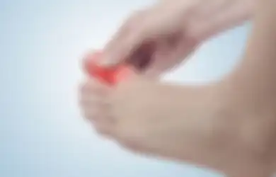 Enggak Perlu Obat, Gini 3 Cara Mudah Mengatasi Kuku Cantengan