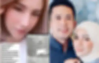 Seret Nama Aufar Hutapea, Selebgram Ini Ngaku Dilecehkan Bagian Sensitifnya hingga Dianiaya Sampai Pincang, Suami Olla Ramlan Angkat Bicara