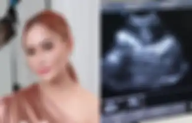 Padahal Ngaku Ogah Punya Anak Lagi, Inul Daratista Mendadak Pamer Foto USG, Sang Pendangdut: Akhirnya Setelah Penantian Lama...