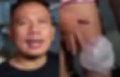 Keok! Cuma Tahan 2 Ronde Lawan Mantan Anak Sambung Gara-gara Lutut Cedera, Vicky Prasetyo Dapat Sindiran ini dari Aldi Taher