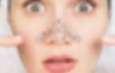 Komedo di Hidung Bikin Penampilan Kurang Mendukung? Berikut 6 Cara Mengatasinya