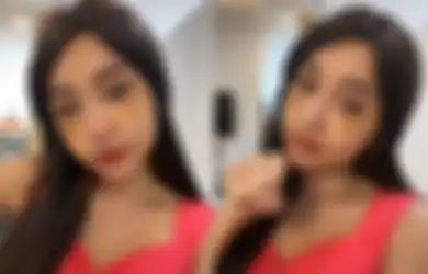 'Wajah Gue Dibelek', Impian Miliki Kecantikan yang Hakiki Terwujud, Lucinta Luna Rela Lakoni Proses Menyakitkan saat Jalani Operasi Ganti Kepala, Begini Curhatnya