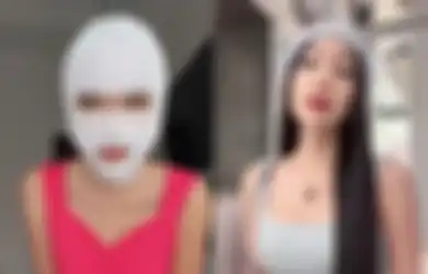Kini Mampu Jalani Operasi Plastik Senilai Rp 1 Miliar, Lucinta Luna Dulu Sempat Jadi Wanita Simpanan Para Sugar Daddy: Ada Syaratnya...