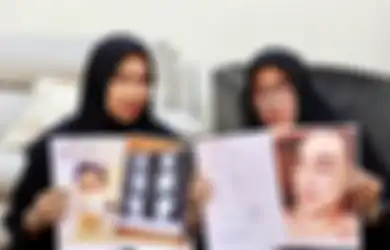 Nasi Sudah Jadi Bubur, Chika Nangis Bukan Gegara Nur Alamsyah, Ustaz Derry Sulaiman Sampai Minta Hidayah di Foto Rico Valentino yang Babak Belur