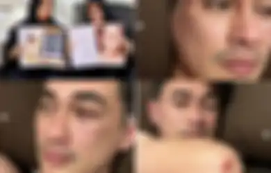 'Patahkan' Keterangan Chika, Sahabat Ungkap Rico Valentino Tak Mabuk hingga Sebut Ada Kabar Gembira untuk Pihak Polisi, Apa Itu?