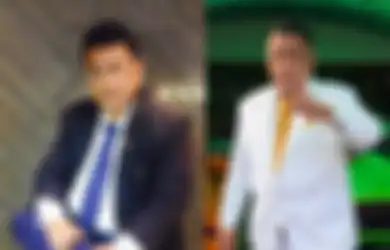 Tubuhnya Mendadak Kurus Bak Orang Penyakitan, Hotman Paris Buru-buru Lakukan Tes HIV dan Kanker, Hasilnya Sunnguh Tak Terduga