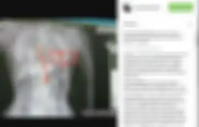 Korbannya Ditemukan Tewas Terbaring Bersimbah Darah dengan Tubuh Tertancap Gagang Pacul, Otak Pelaku Pemerkosaan dan Pembunuhan Eno Farihah Justru Lolos dari Hukuman Mati, Kok Bisa?