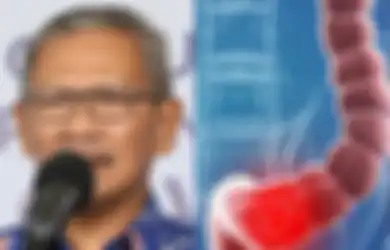 Mengenal Kanker Usus yang Sebabkan Achmad Yurianto Meregang Nyawa, Ini Gejala dan Cara Mencegahnya