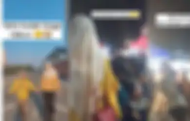 Kerap Dijuluki Jerapah hingga Dikira Patung, Wanita Ini Miliki Tinggi Badan yang Tak Lazim Capai 186 Cm, Ternyata Sekeluarga Idap Penyakit Langka yang Sama!