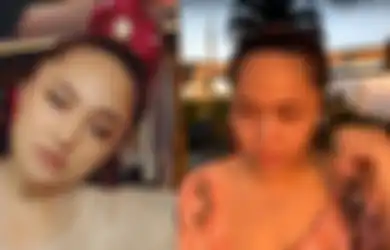 Kaum Hawa Wajib Simak, Kenali Gejala dan Ciri-ciri Tumor Payudara Seperti yang Diidap Marshanda, Ternyata Bisa Dilakukan dengan Deteksi Dini Lewat Metode Ini!