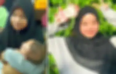 Apes Banget, Niat Memperbaiki Kulit Pakai Produk Kecantikan, Wajah Gadis Ini Malah Rusak dan Menipis, Dokter Ungkap Penyebabnya yang Bikin Syok!